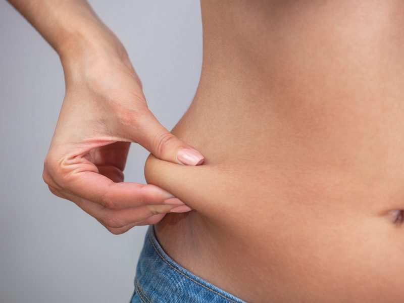 Mini Tummy Excess Skin Removal UK Skin